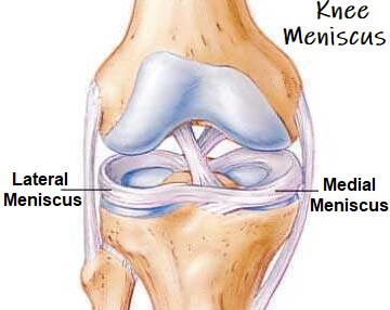 knee-mensicus-guidejpg